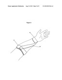 Supinating Arm and Elbow Brace diagram and image