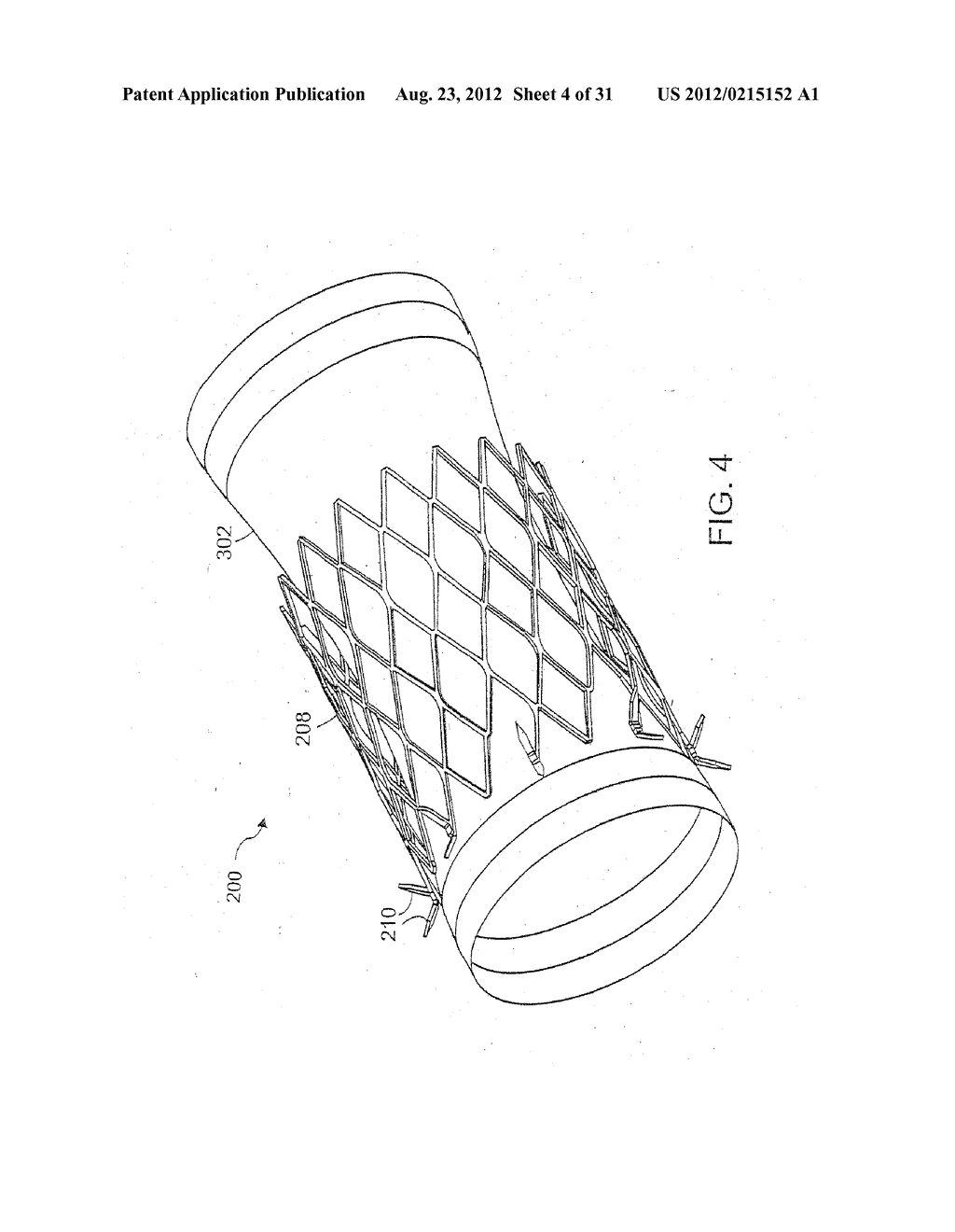 BARIATRIC SLEEVE - diagram, schematic, and image 05