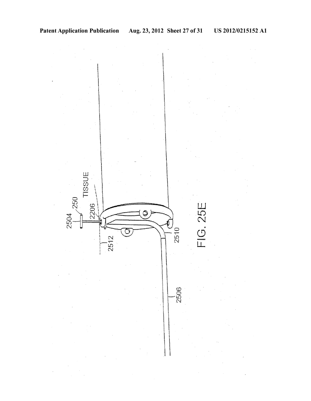 BARIATRIC SLEEVE - diagram, schematic, and image 28