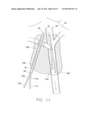 Splittable Multiple Catheter Assembly diagram and image