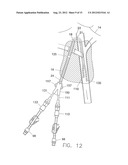 Splittable Multiple Catheter Assembly diagram and image