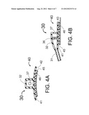 INTRODUCER SHEATH WITH THIN-WALLED SHAFT AND IMPROVED MEANS FOR ATTACHMENT     TO THE SKIN diagram and image