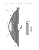 SANITARY PAD WITH INCREASED ABSORBABILITY diagram and image