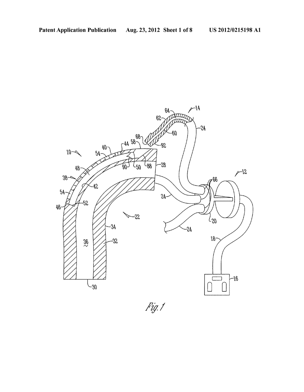 APPARATUS AND SYSTEM FOR ADMINISTERING MEDICATION - diagram, schematic, and image 02