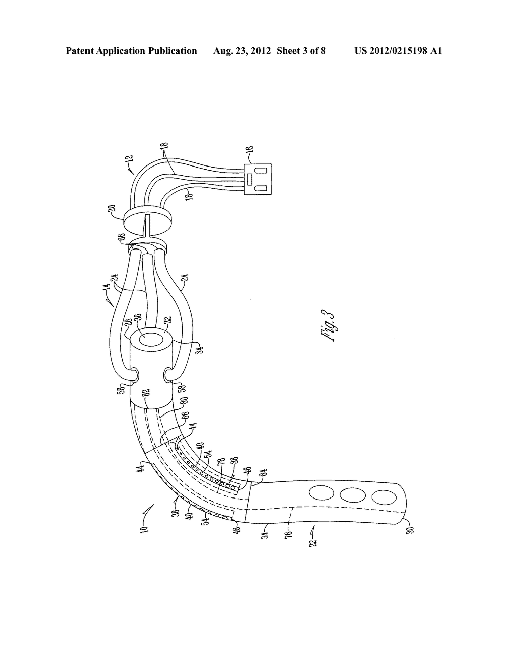 APPARATUS AND SYSTEM FOR ADMINISTERING MEDICATION - diagram, schematic, and image 04