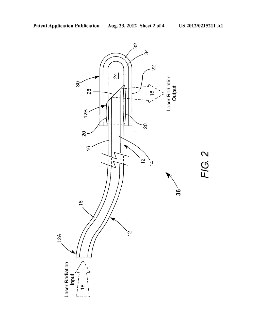 DELIVERY FIBER FOR SURGICAL LASER TREATMENT AND METHOD FOR MAKING SAME - diagram, schematic, and image 03