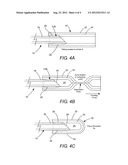 DELIVERY FIBER FOR SURGICAL LASER TREATMENT AND METHOD FOR MAKING SAME diagram and image