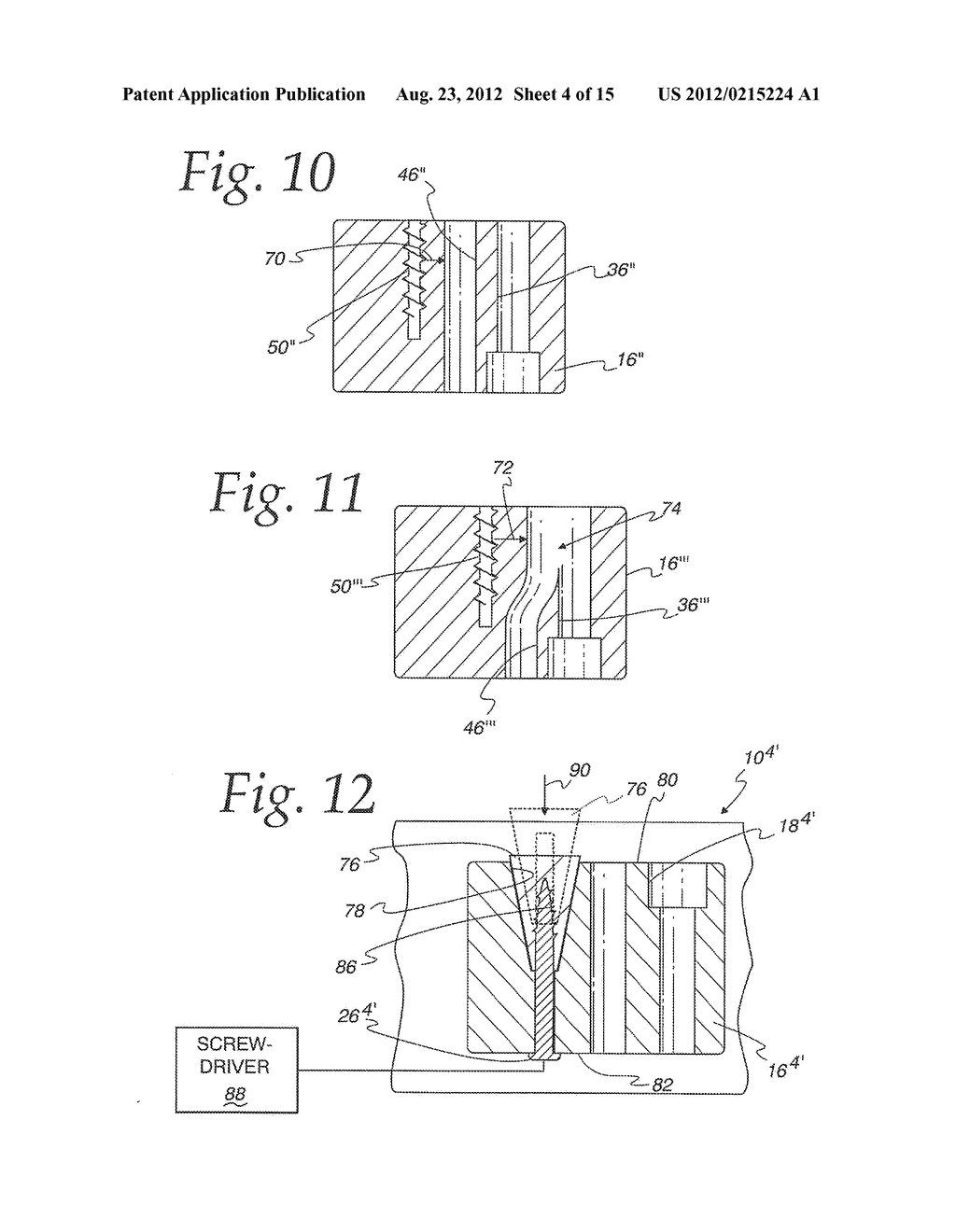 CABLE SYSTEM FOR SURGICAL APPLICATION - diagram, schematic, and image 05