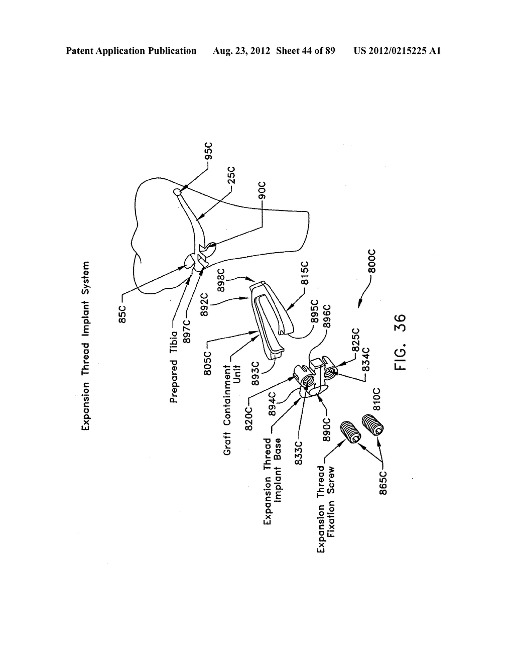 METHOD AND APPARATUS FOR PERFORMING AN OSTEOTOMY IN BONE - diagram, schematic, and image 45