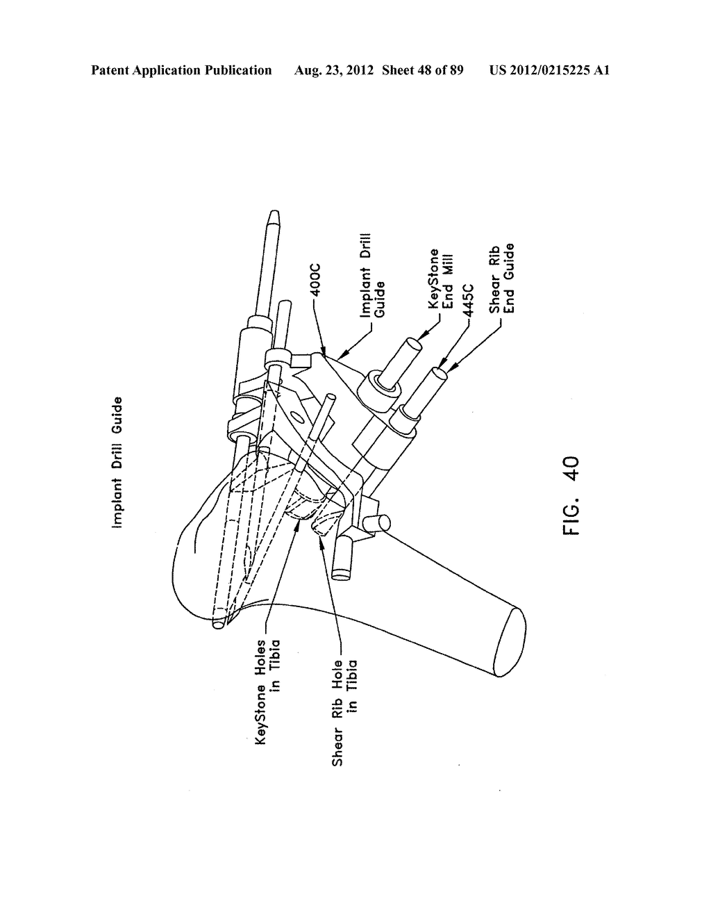 METHOD AND APPARATUS FOR PERFORMING AN OSTEOTOMY IN BONE - diagram, schematic, and image 49