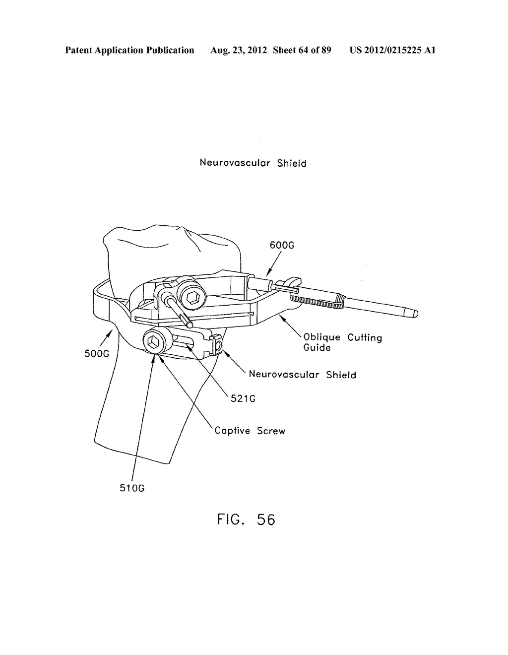 METHOD AND APPARATUS FOR PERFORMING AN OSTEOTOMY IN BONE - diagram, schematic, and image 65