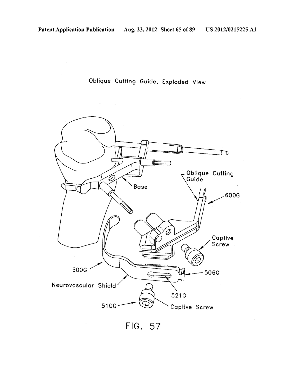 METHOD AND APPARATUS FOR PERFORMING AN OSTEOTOMY IN BONE - diagram, schematic, and image 66