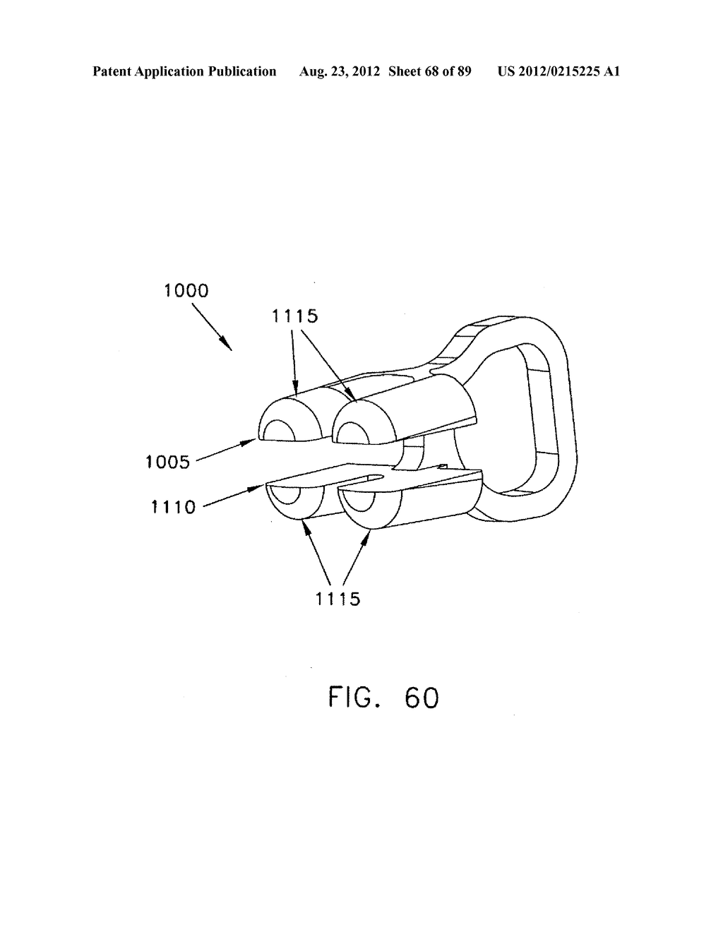 METHOD AND APPARATUS FOR PERFORMING AN OSTEOTOMY IN BONE - diagram, schematic, and image 69