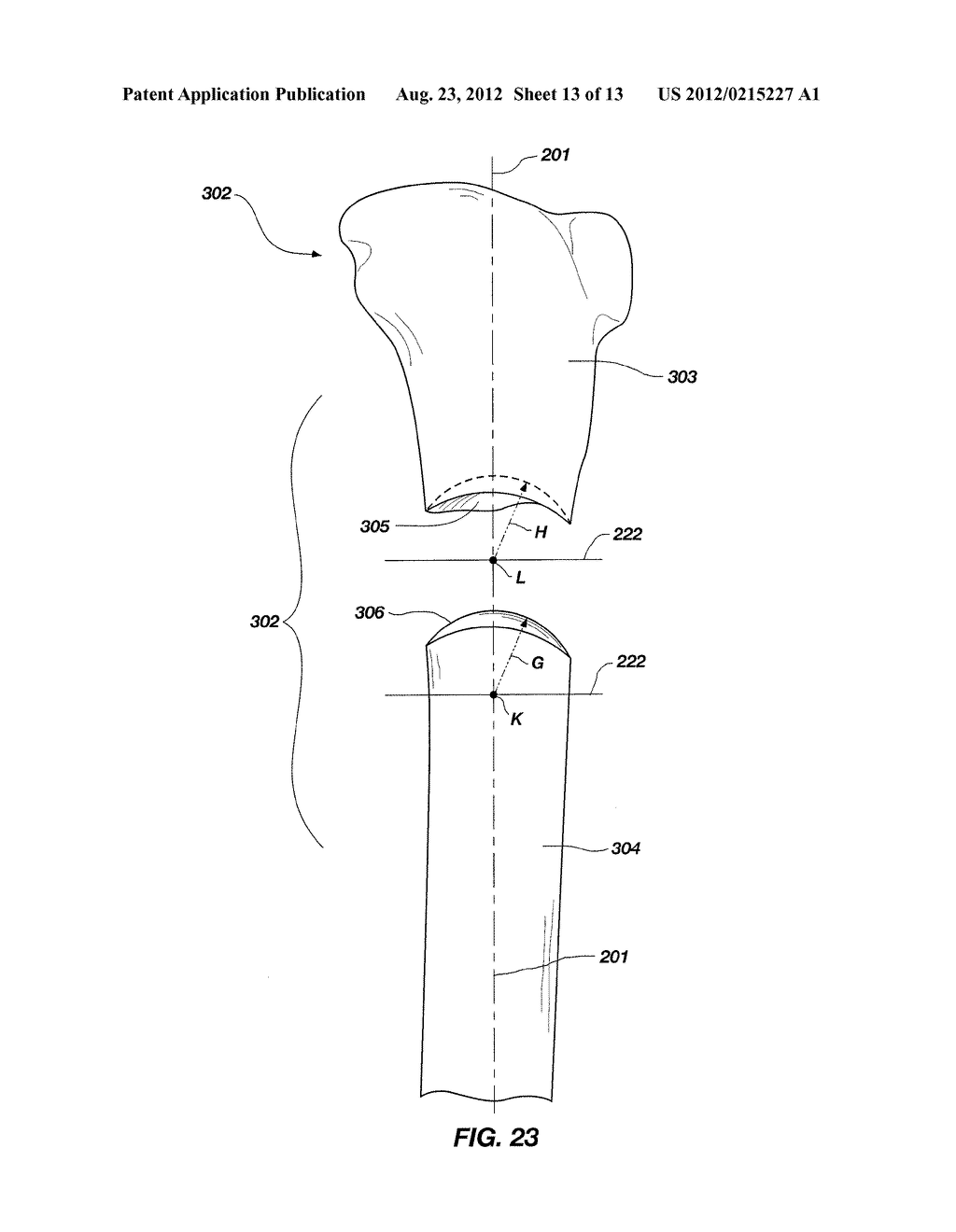 METHOD OF PLANNING AND PERFORMING A SPHERICAL OSTEOTOMY USING THE     3-DIMENSIONAL CENTER OF ROTATION OF ANGULATION (CORA) - diagram, schematic, and image 14