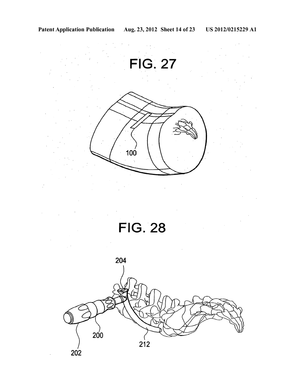 CURVILINEAR SPINAL ACCESS METHOD AND DEVICE - diagram, schematic, and image 15