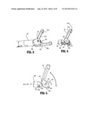 Single Actuating Jaw Flexible Endolumenal Stitching Device diagram and image