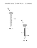 TROCAR WITH RETENTION CANNULA diagram and image