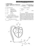 PFO CLOSING DEVICE diagram and image