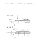 PFO CLOSING DEVICE diagram and image