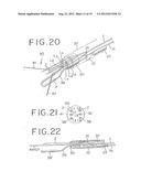 PFO CLOSING DEVICE diagram and image