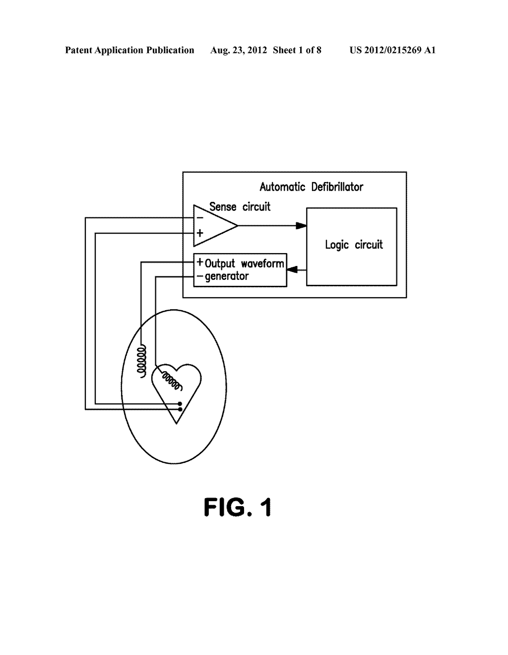 Method and Device for Treating Cardiac Arrhythmias - diagram, schematic, and image 02