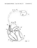 ACCELEROMETER ENHANCED IMPLANTABLE CARDIO-DEVICE diagram and image