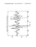 ACCELEROMETER ENHANCED IMPLANTABLE CARDIO-DEVICE diagram and image