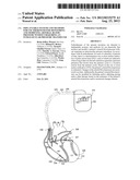 IMPLANTABLE SYSTEMS AND METHODS FOR USE THEREWITH FOR MONITORING AND     MODIFYING ARTERIAL BLOOD PRESSURE WITHOUT REQUIRING AN INTRAVASCULAR     PRESSURE TRANSDUCER diagram and image