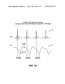 IMPLANTABLE SYSTEMS AND METHODS FOR USE THEREWITH FOR MONITORING AND     MODIFYING ARTERIAL BLOOD PRESSURE WITHOUT REQUIRING AN INTRAVASCULAR     PRESSURE TRANSDUCER diagram and image