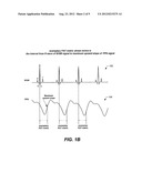 IMPLANTABLE SYSTEMS AND METHODS FOR USE THEREWITH FOR MONITORING AND     MODIFYING ARTERIAL BLOOD PRESSURE WITHOUT REQUIRING AN INTRAVASCULAR     PRESSURE TRANSDUCER diagram and image