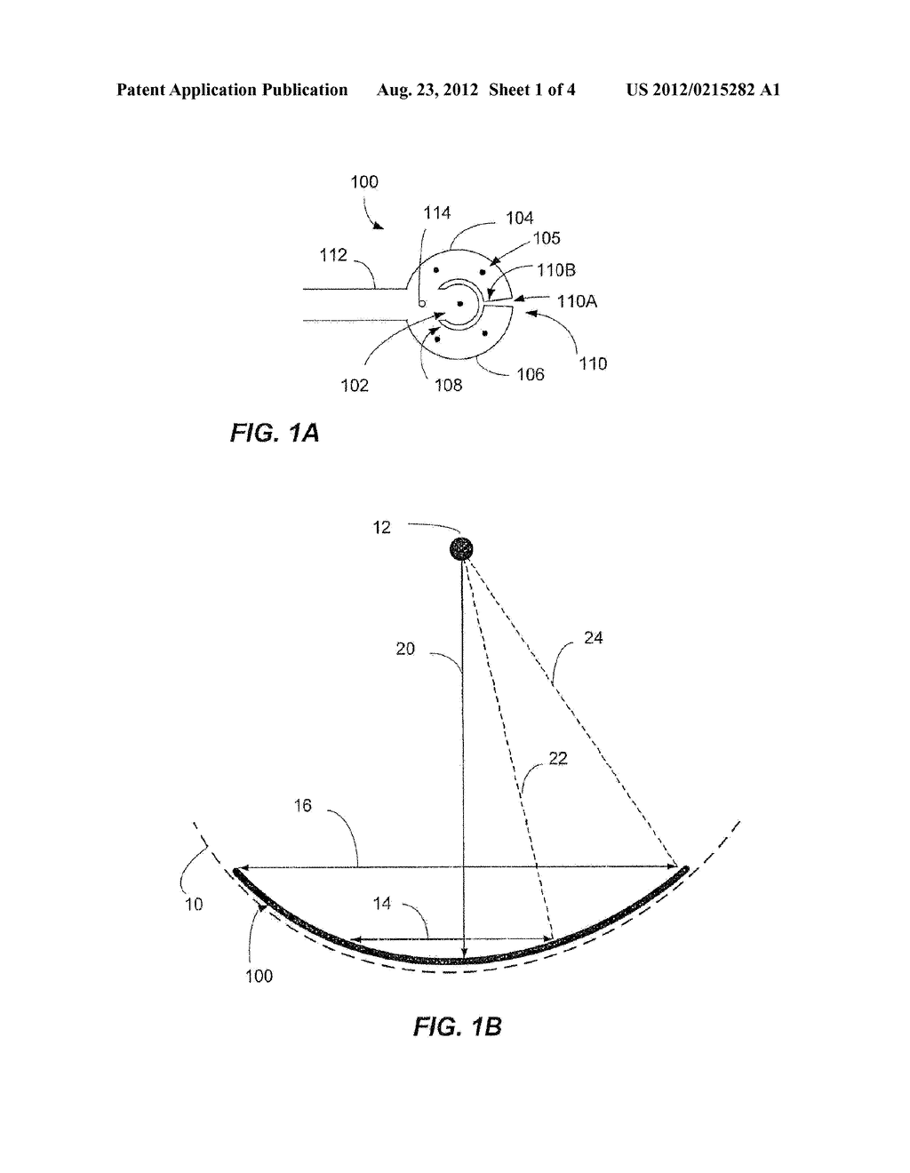 Wide-Field Retinal Prosthesis - diagram, schematic, and image 02