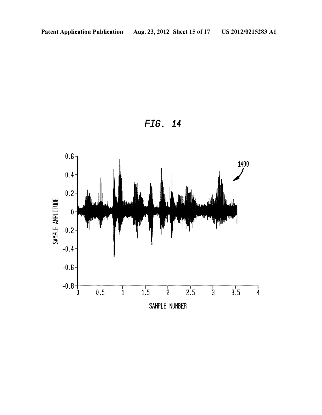 RECORDING AND RETRIEVAL OF SOUND DATA IN A HEARING PROSTHESIS - diagram, schematic, and image 16