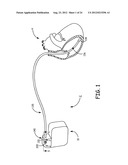 LEAD RETENTION AND SEALING DEVICE diagram and image