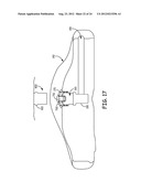 LEAD RETENTION AND SEALING DEVICE diagram and image