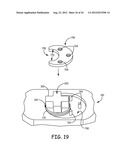 LEAD RETENTION AND SEALING DEVICE diagram and image