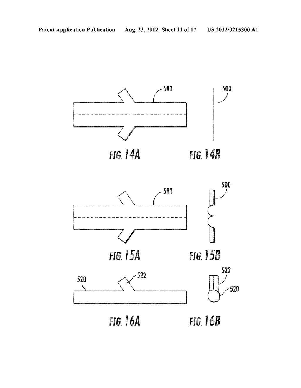 METHOD AND APPARATUS FOR BYPASS GRAFT - diagram, schematic, and image 12