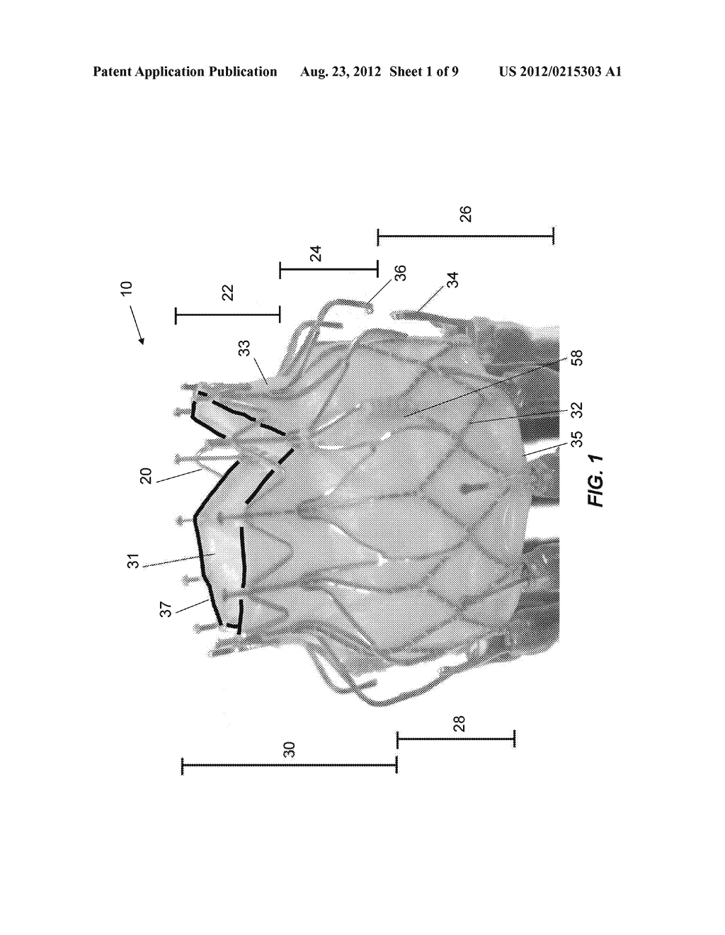 REPLACEMENT HEART VALVE AND METHOD - diagram, schematic, and image 02