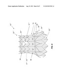 REPLACEMENT HEART VALVE AND METHOD diagram and image