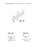 BIOABSORBABLE MULTILAYER NASAL VALVE SPREADER GRAFT diagram and image