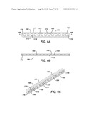 BIOABSORBABLE MULTILAYER NASAL VALVE SPREADER GRAFT diagram and image