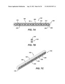 BIOABSORBABLE MULTILAYER NASAL VALVE SPREADER GRAFT diagram and image