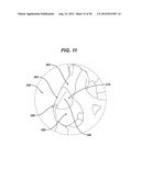 BIOABSORBABLE MULTILAYER NASAL VALVE SPREADER GRAFT diagram and image