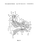 POWER TRANSFER TO A MEDICAL IMPLANT LOCATED ADJACENT TISSUE WHILE     PREVENTING SHORT CIRCUITS THROUGH THE TISSUE diagram and image