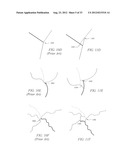 POROUS IMPLANT STRUCTURES diagram and image