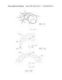 POROUS IMPLANT STRUCTURES diagram and image