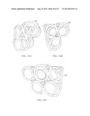 POROUS IMPLANT STRUCTURES diagram and image