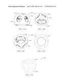 POROUS IMPLANT STRUCTURES diagram and image