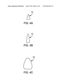 ARTHROPLASTY SHIM diagram and image