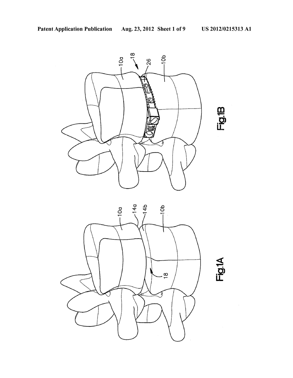 EXPANDABLE INTERBODY FUSION IMPLANT - diagram, schematic, and image 02