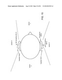 SYSTEMS, METHODS, APPARATUS, AND COMPUTER-READABLE MEDIA FOR SPATIALLY     SELECTIVE AUDIO AUGMENTATION diagram and image